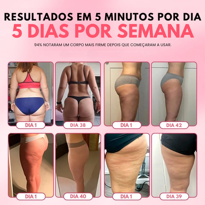 AlluShape 2.0 - Potente redutor de celulite & lipedema