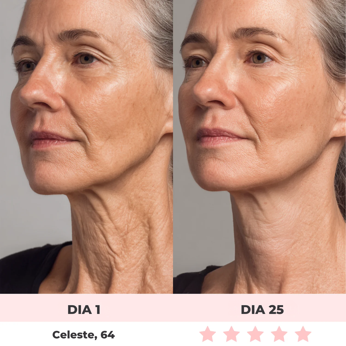 Alluface 7 em 1 - Tratamento facial completo [rugas-flacidez-papada]