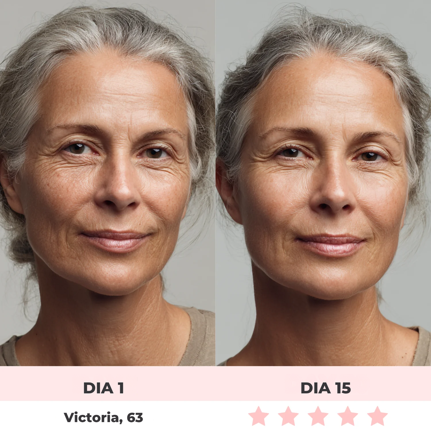 Alluface 7 em 1 - Tratamento facial completo [rugas-flacidez-papada]